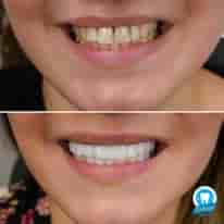 Turkiye Dental in , Turkey Reviews from Real Patients Slider image 4