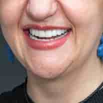 Turkiye Dental in , Turkey Reviews from Real Patients Slider image 7