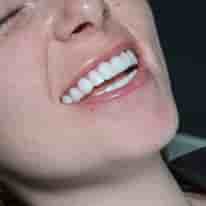 Turkiye Dental in , Turkey Reviews from Real Patients Slider image 9