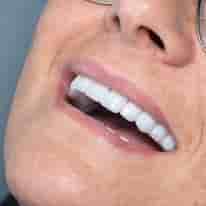 Turkiye Dental in , Turkey Reviews from Real Patients Slider image 10