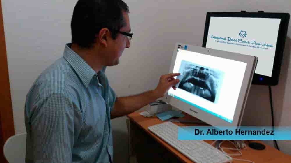 International Dental Center in Puerto Vallarta, Mexico Reviews from Real Patients Slider image 6