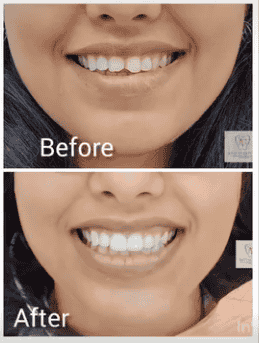 Dr. A & T Dental Experts in , India Reviews from Real Patients Slider image 10