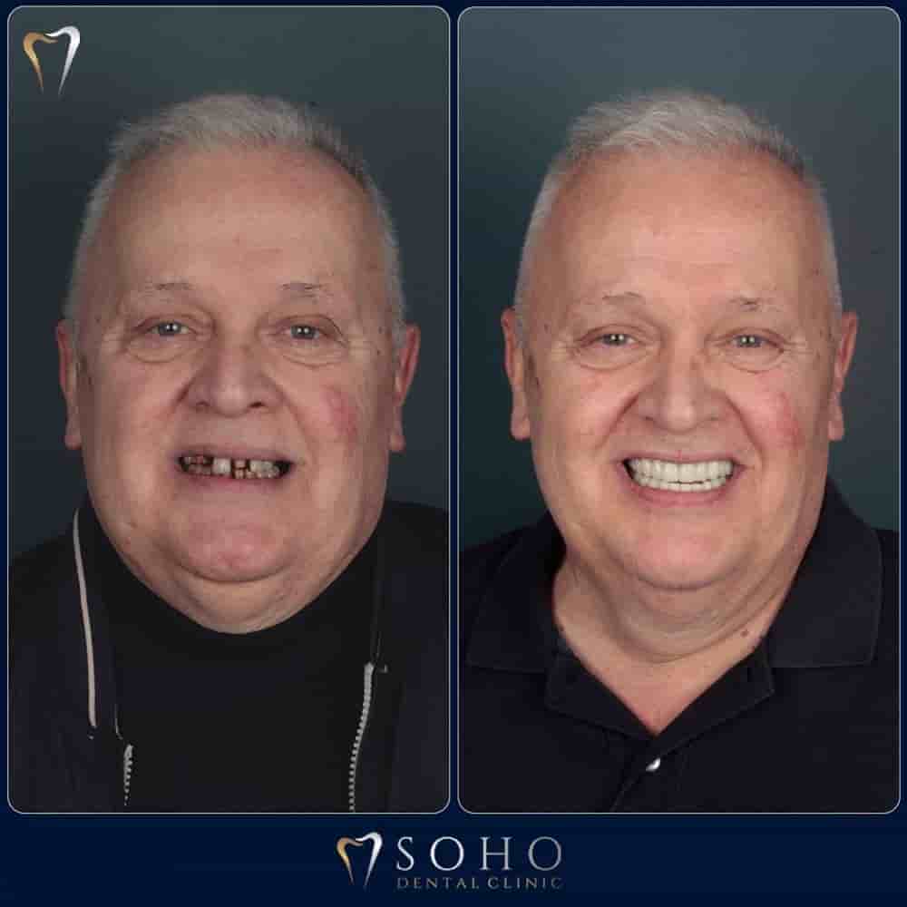 Soho Dental Clinic in Istanbul, Turkey Reviews from Real Patients Slider image 1