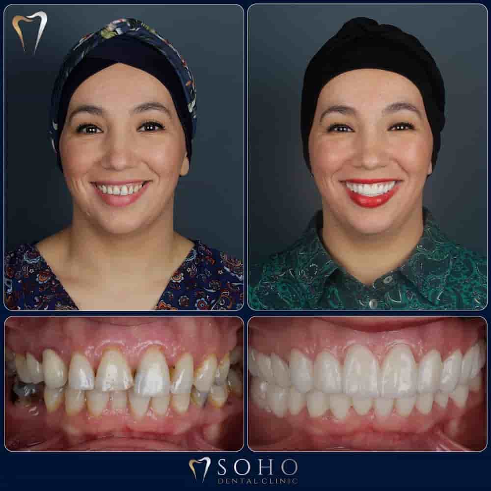 Soho Dental Clinic in Istanbul, Turkey Reviews from Real Patients Slider image 3