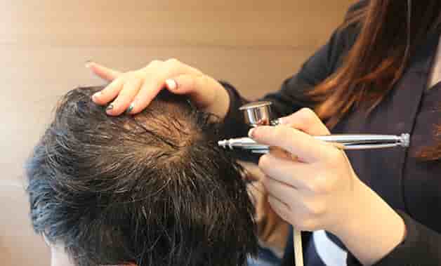 MOAMAN Hair Transplant Clinic in Seoul, South Korea Reviews from Real Patients Slider image 5