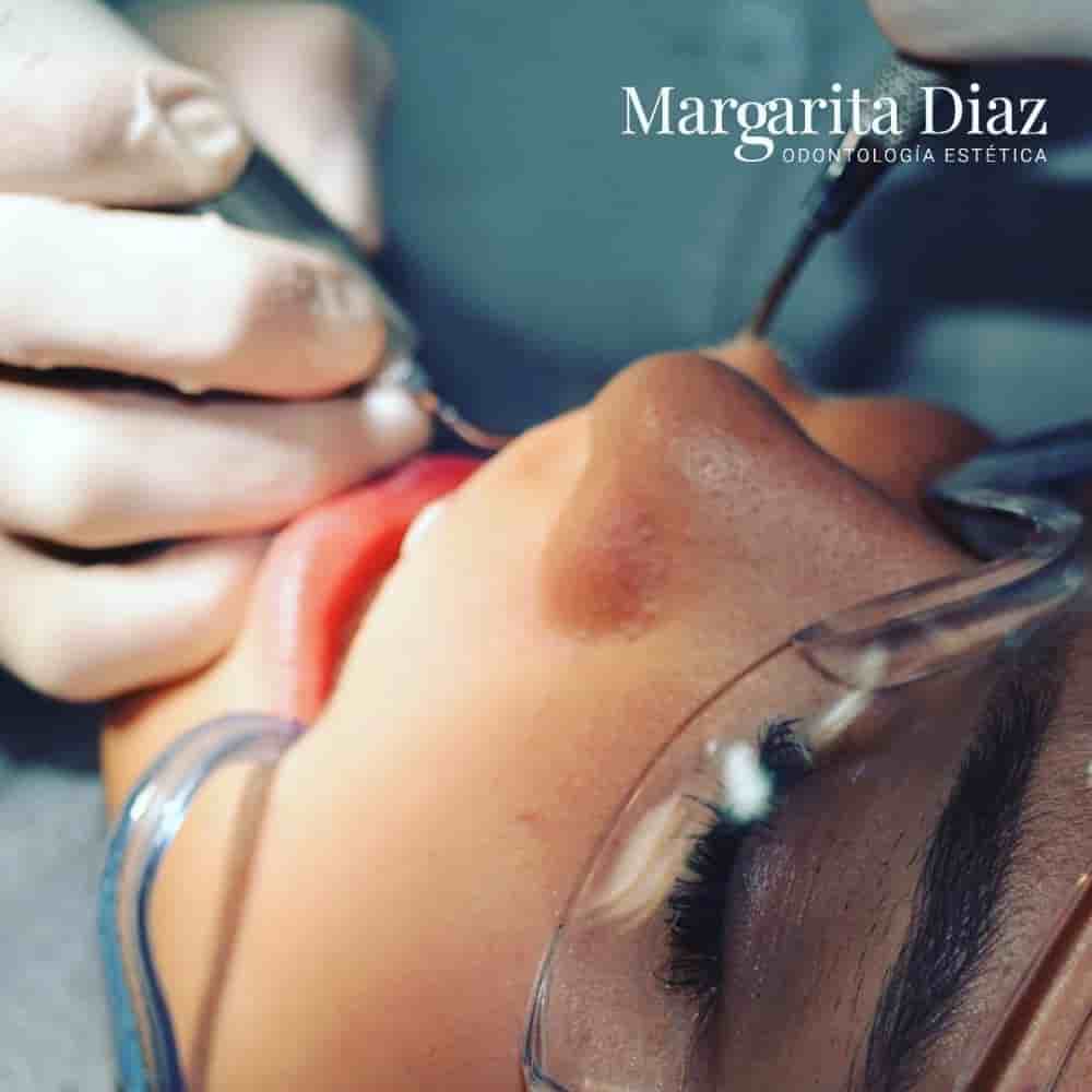 Margarita Diaz Odontologia Estetica in Mexico City, Mexico Reviews from Real Patients Slider image 3