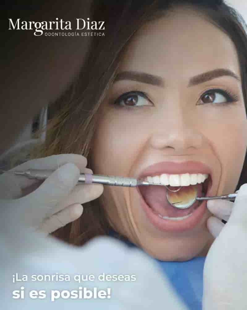 Margarita Diaz Odontologia Estetica in Mexico City, Mexico Reviews from Real Patients Slider image 5