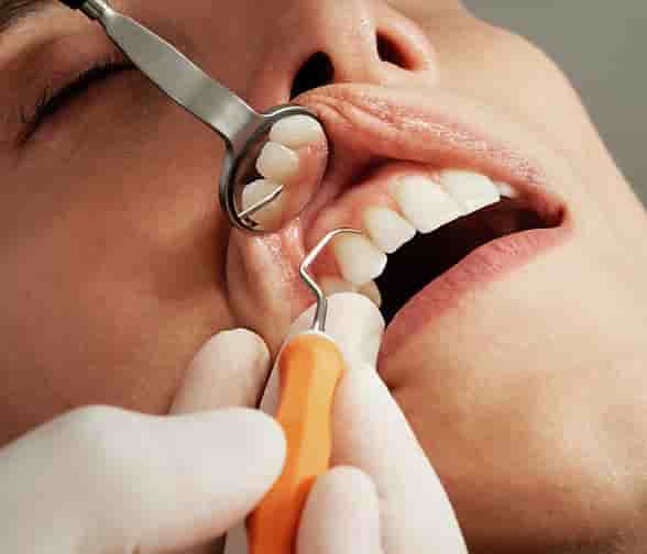 Neo Dental Clinic in Tirana, Albania Reviews from Real Patients Slider image 4