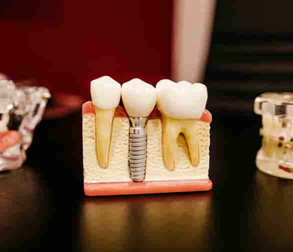 Neo Dental Clinic in Tirana, Albania Reviews from Real Patients Slider image 5