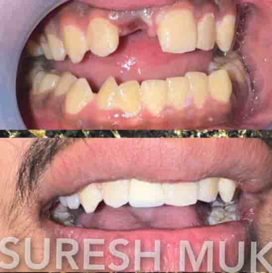 THE DENTAL PORT in Noida, India Reviews from Real Patients Slider image 2