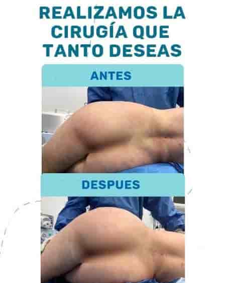 Dr. Adan Perez Lopez  in Tampico, Mexico Reviews from Real Patients Slider image 6