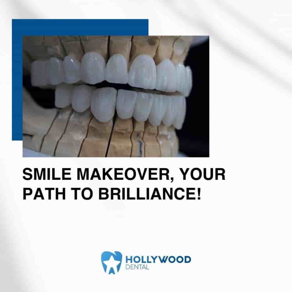 Hollywood Dental Izmir Turkey in Izmir, Turkey Reviews from Real Patients Slider image 4