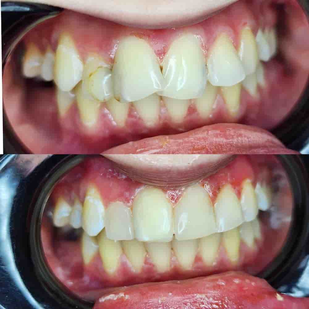 Dr. Boneva Dentist in Varna, Bulgaria Reviews from Real Patients Slider image 1