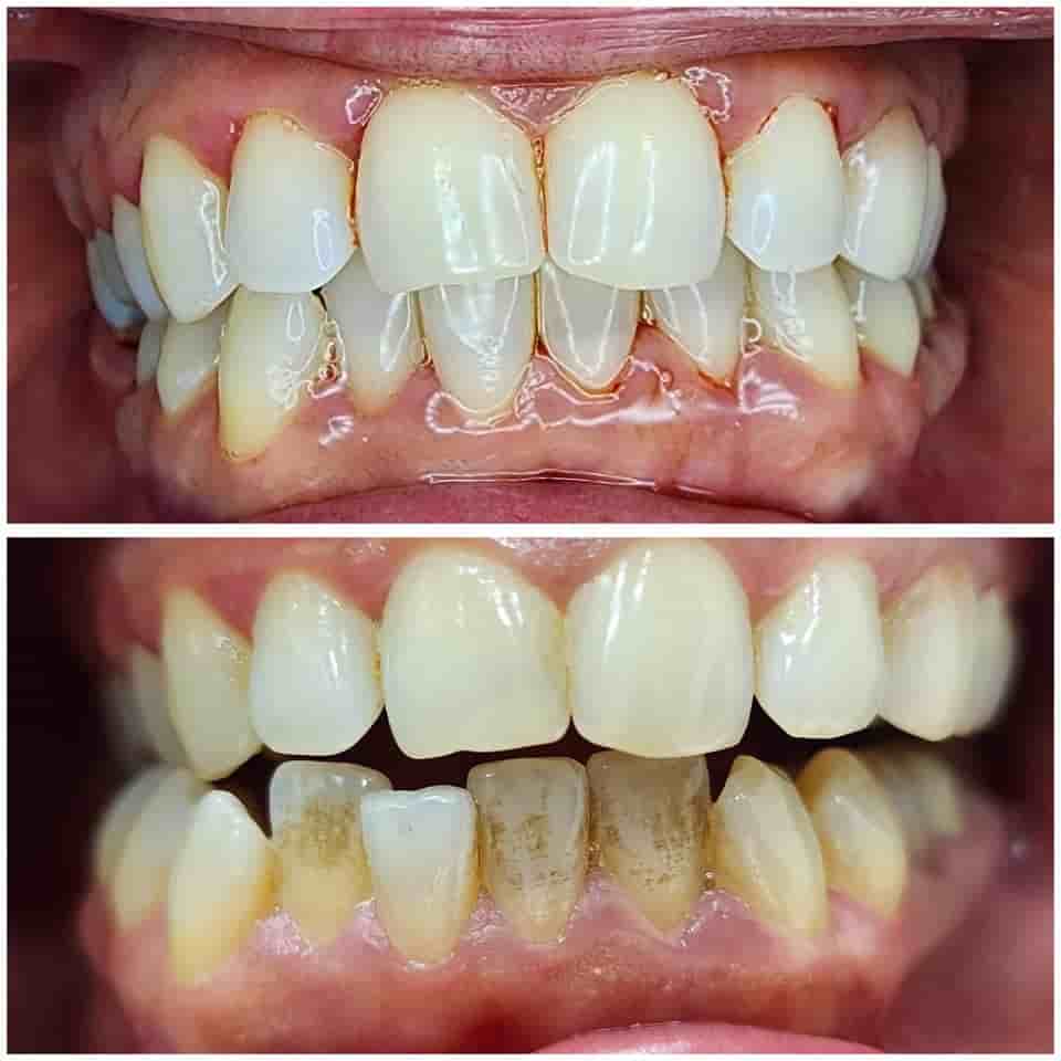 Dr. Boneva Dentist in Varna, Bulgaria Reviews from Real Patients Slider image 4