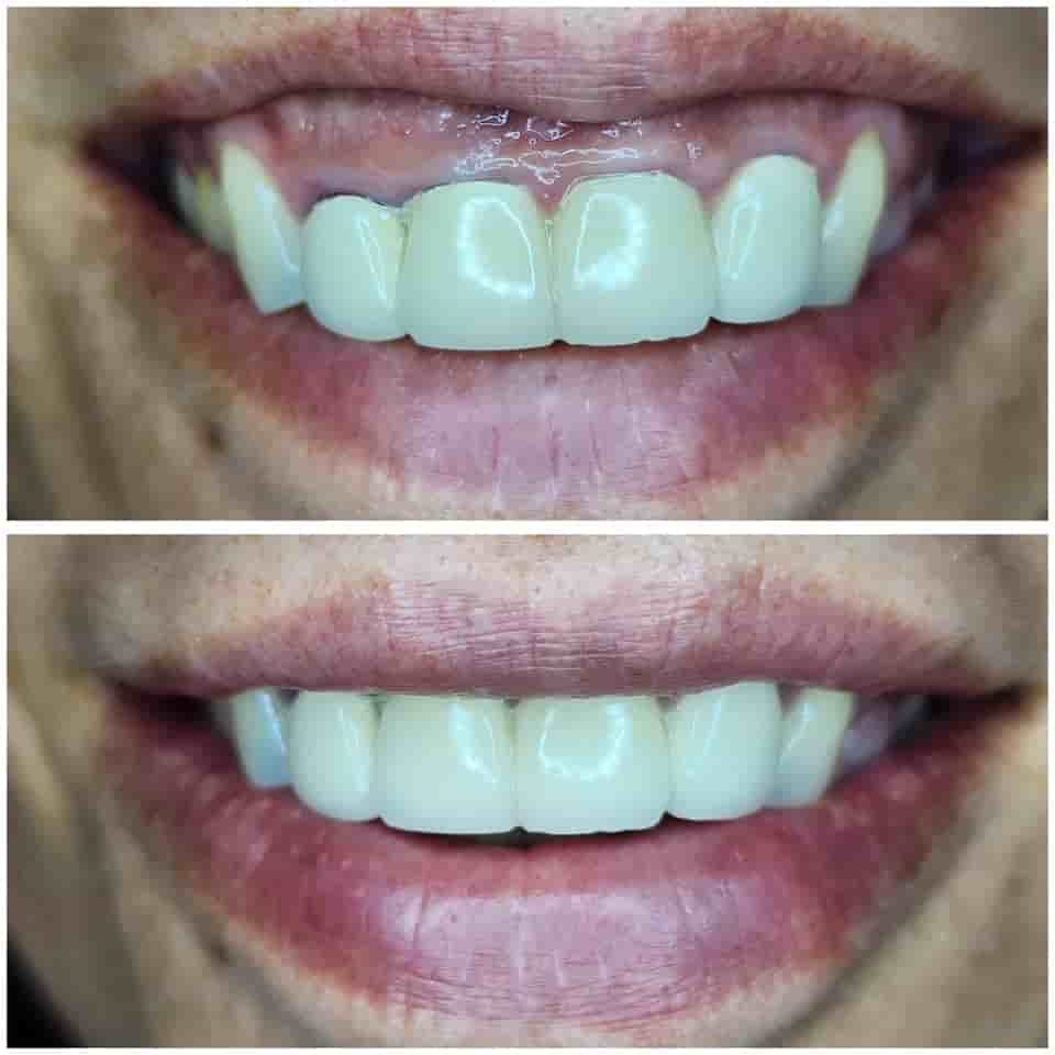 Dr. Boneva Dentist in Varna, Bulgaria Reviews from Real Patients Slider image 5