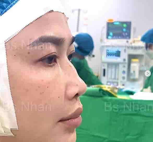 Dr. Nhan Ho Aesthetics and Plastic Surgery in Ho Chi Minh, Vietnam Reviews from Real Patients Slider image 6