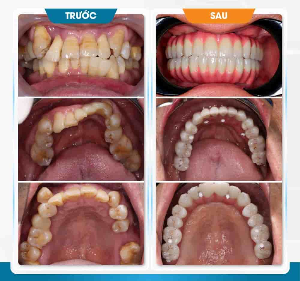 Dr. Care Implant Clinic in Ho Chi Minh, Vietnam Reviews from Real Patients Slider image 2