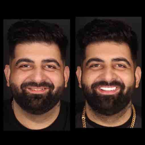 Dr. Halil Kural in Antalya, Turkey Reviews from Real Patients Slider image 7