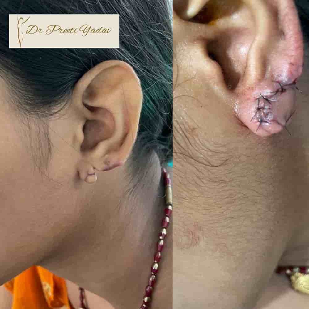 Konarc Aesthetics - Plastic & Cosmetic Surgery In Gurgaon, India. in Gurgaon, India Reviews from Real Patients Slider image 4