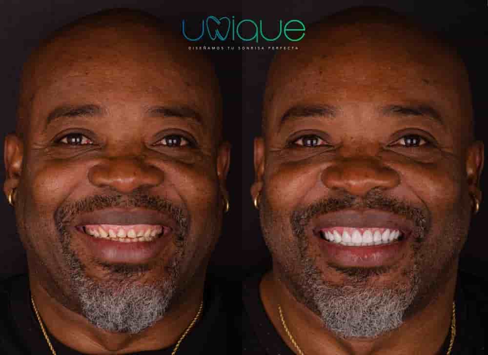 Unique Dental Clinic in Cancun, Mexico Reviews from Real Patients Slider image 5