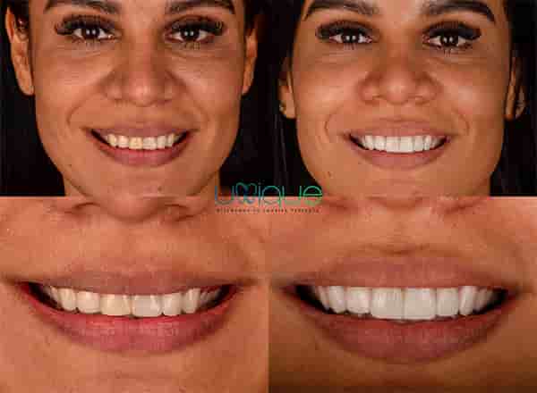 Unique Dental Clinic in Cancun, Mexico Reviews from Real Patients Slider image 3