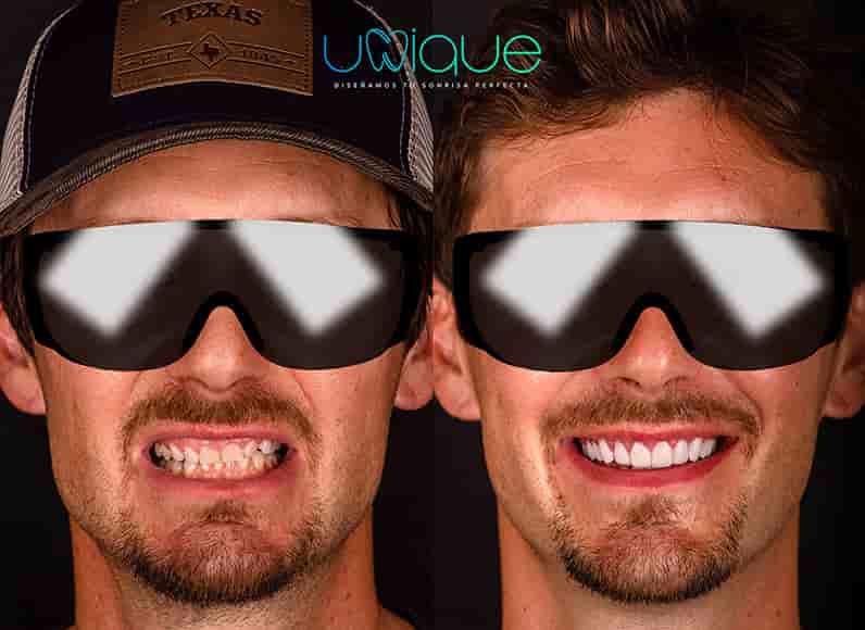 Unique Dental Clinic in Cancun, Mexico Reviews from Real Patients Slider image 2