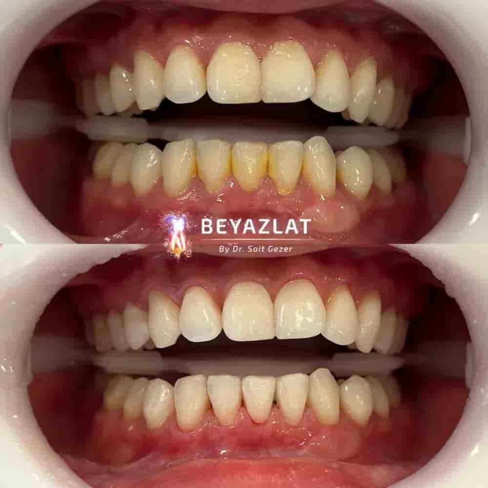 Dr. Sait Gezer in Istanbul, Turkey Reviews from Real Patients Slider image 8