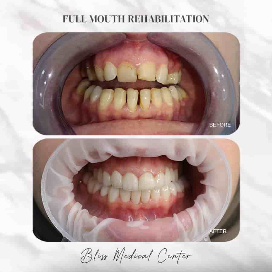 Bliss Medical Centre Ajman, Jurf in Ajman, UAE Reviews from Real Patients Slider image 2