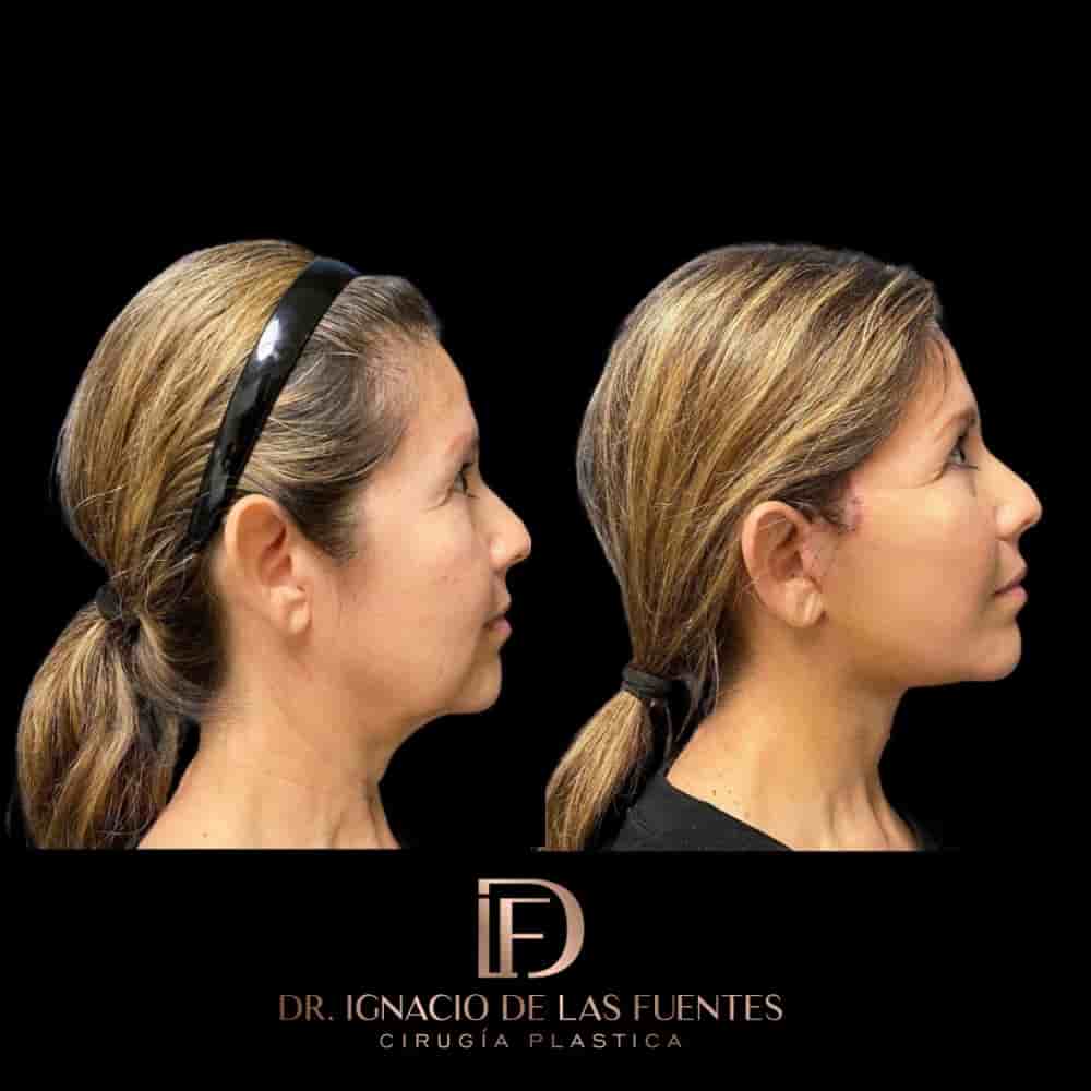 Dr. Ignacio De Las Fuentes in Tijuana, Mexico Reviews from Real Patients Slider image 2