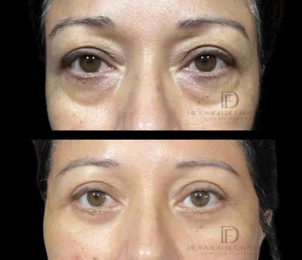 Dr. Ignacio De Las Fuentes in Tijuana, Mexico Reviews from Real Patients Slider image 8