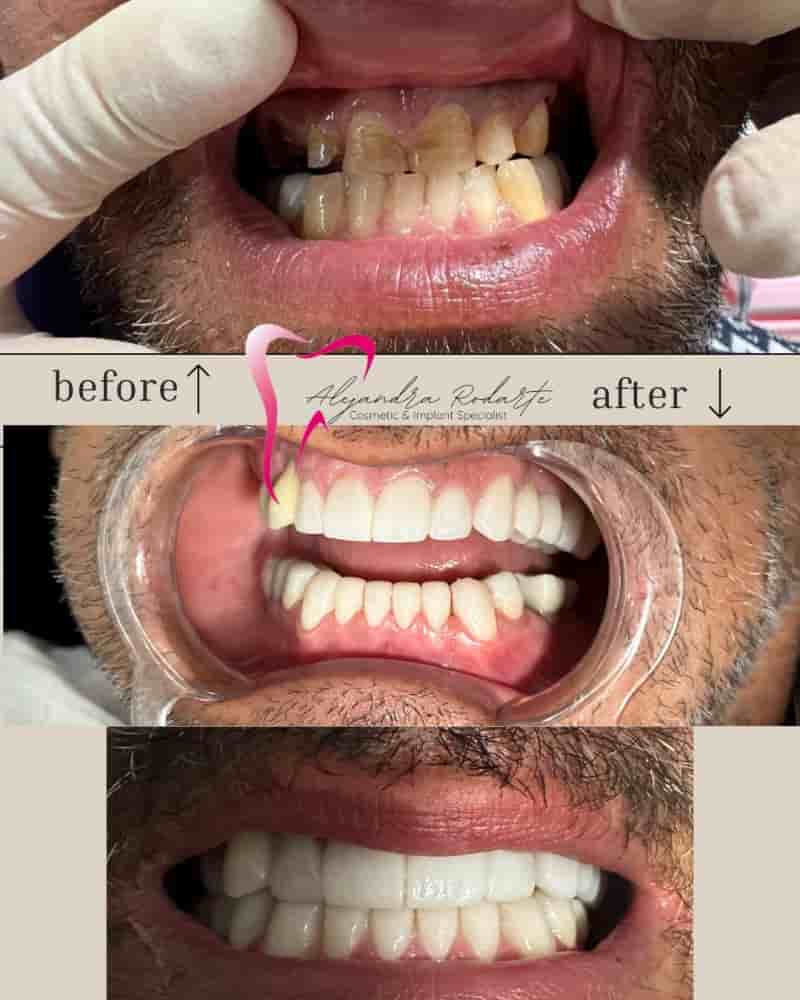 Dr. Alejandra Rodarte Cosmetic & Implant Specialist in Los Algodones, Mexico Reviews from Real Patients Slider image 7
