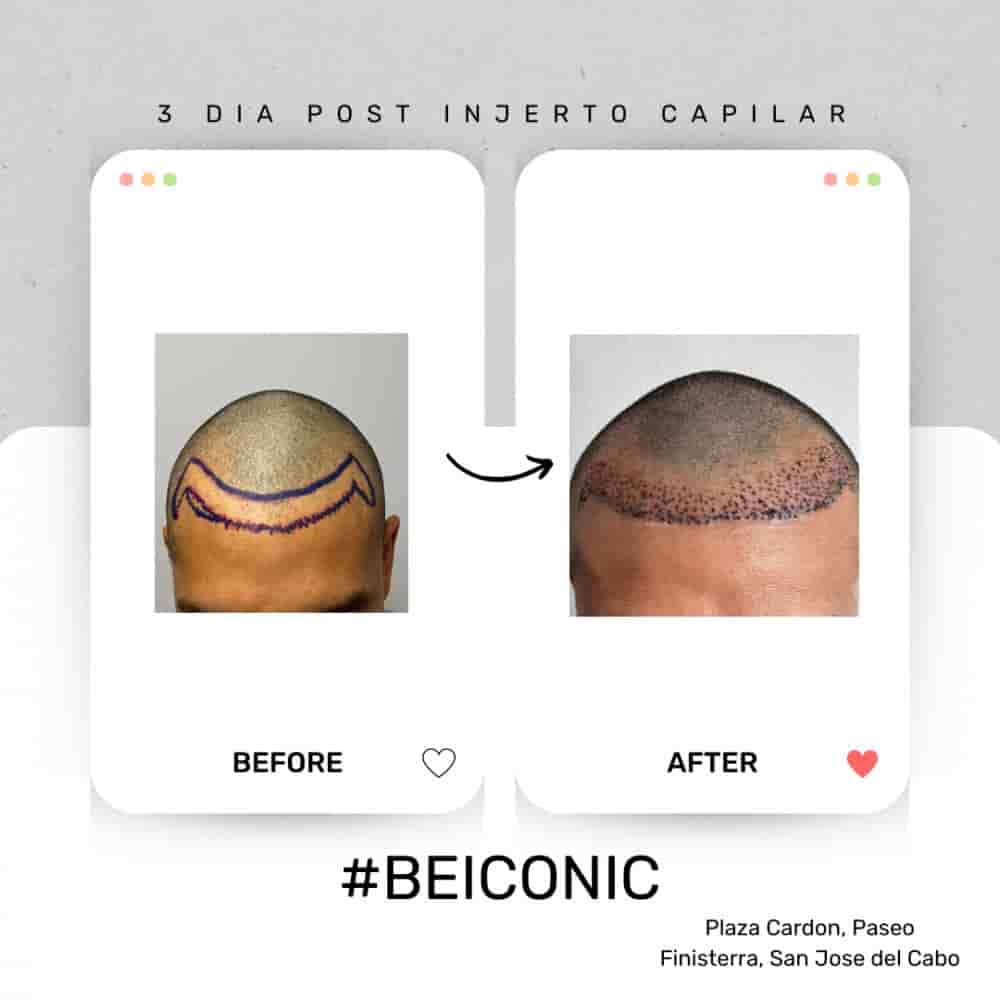 ICONIC Medical Aesthetic in San Jose del Cabo, Mexico Reviews from Real Patients Slider image 9