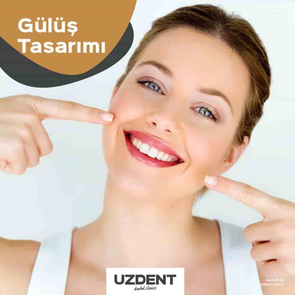 Uzdent Dental Clinics in Istanbul,Kayseri,Nevsehir, Turkey Reviews from Real Patients Slider image 3