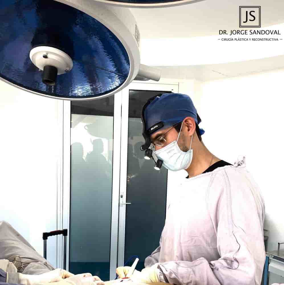 Dr. Jorge Sandoval - Plastic Surgeon in Mexico City in Mexico City, Mexico Reviews from Real Patients Slider image 5