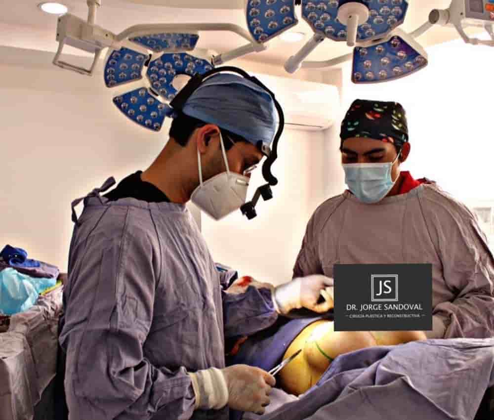 Dr. Jorge Sandoval - Plastic Surgeon in Mexico City in Mexico City, Mexico Reviews from Real Patients Slider image 6