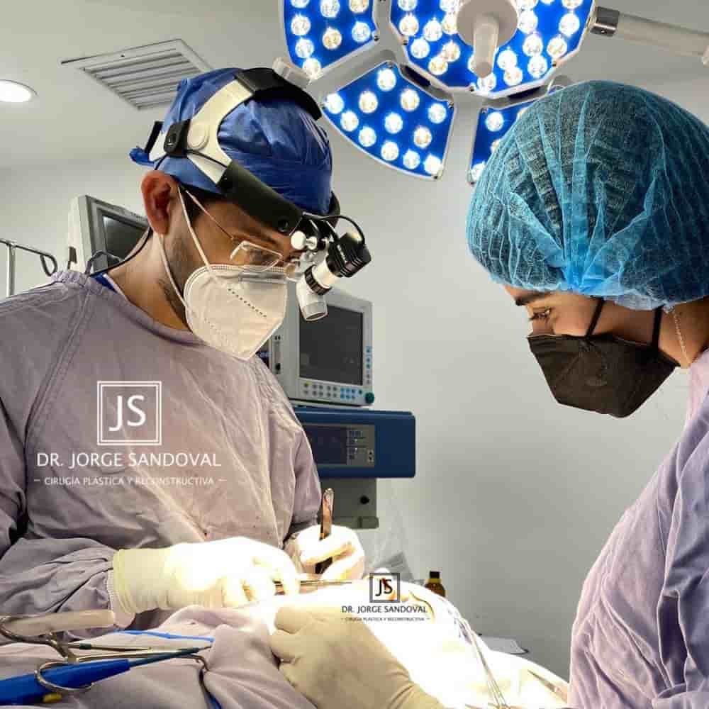 Dr. Jorge Sandoval - Plastic Surgeon in Mexico City in Mexico City, Mexico Reviews from Real Patients Slider image 7