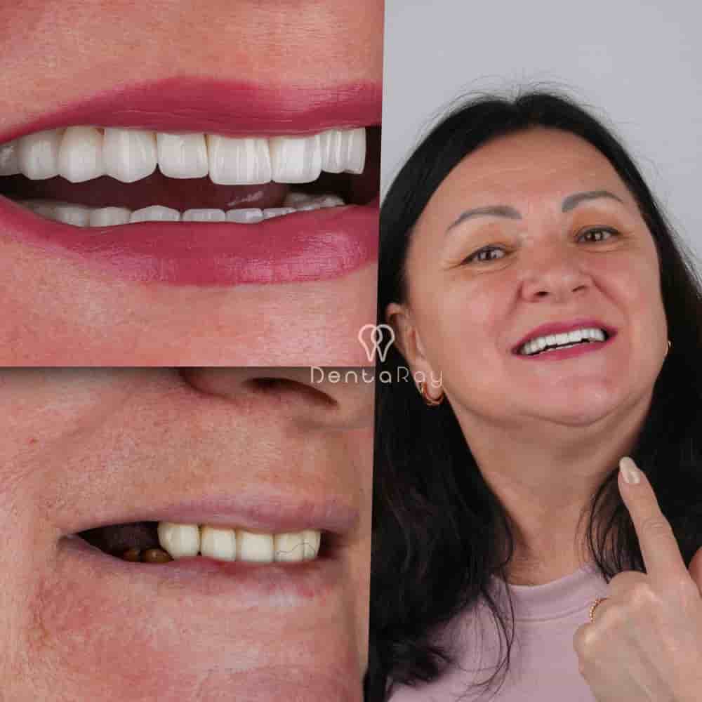 Verified Patient Reviews of Dentaray Clinic luxury Dental Clinic in Istanbul in Istanbul, Turkey Slider image 3