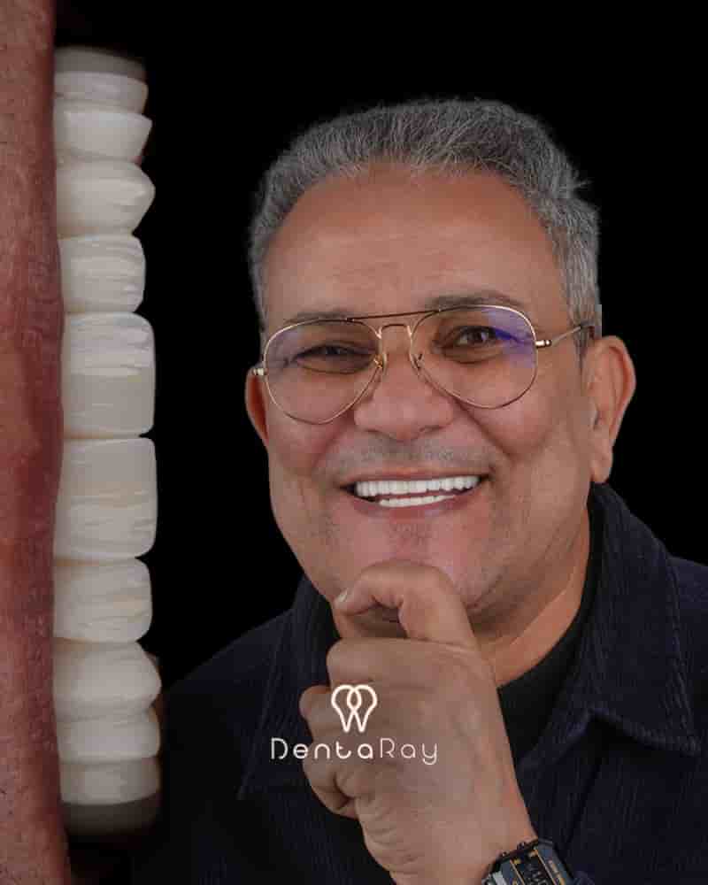 Verified Patient Reviews of Dentaray Clinic luxury Dental Clinic in Istanbul in Istanbul, Turkey Slider image 6