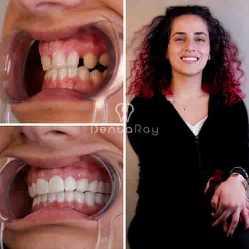 Verified Patient Reviews of Dentaray Clinic: luxury Dental Clinic in Istanbul in Istanbul, Turkey Slider image 8