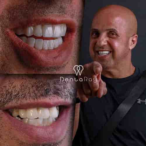 Verified Patient Reviews of Dentaray Clinic: luxury Dental Clinic in Istanbul in Istanbul, Turkey Slider image 9