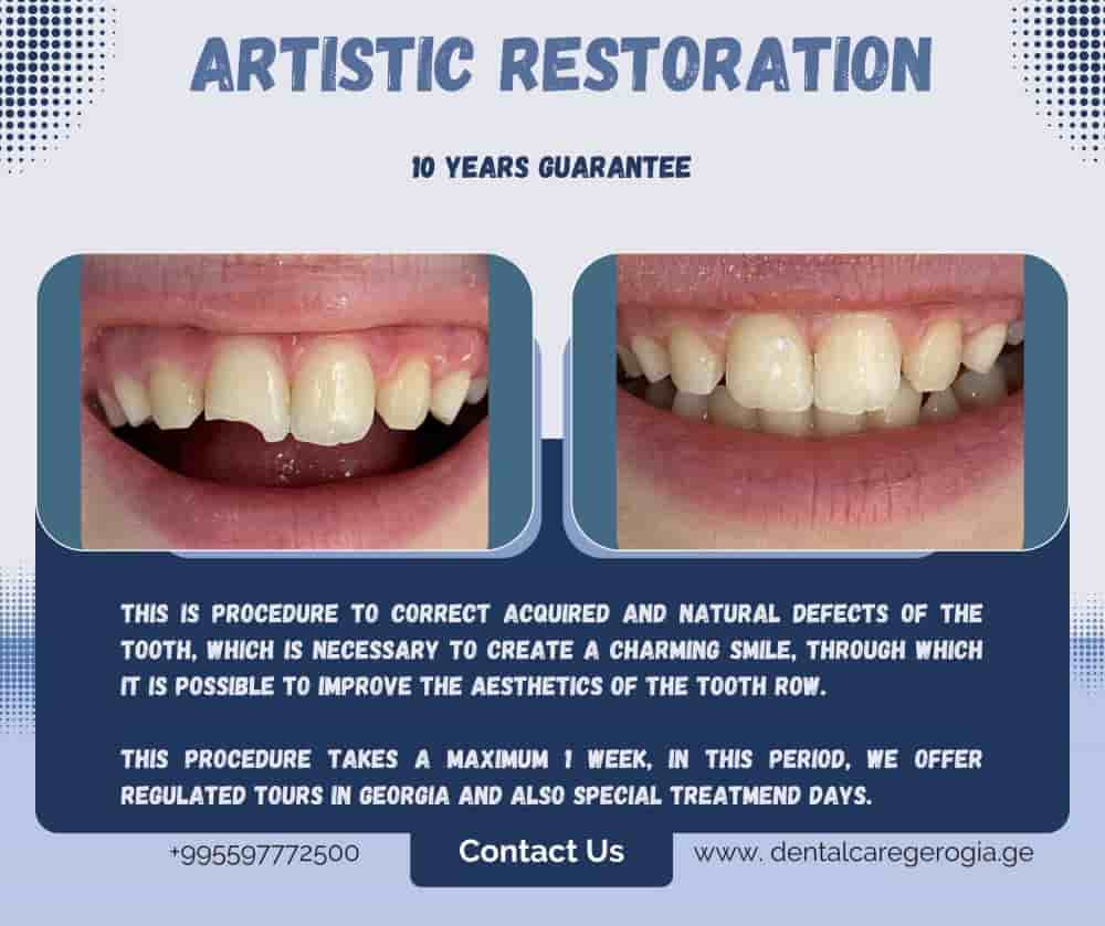 Verified Patient Reviews of Universe Dental - Best Dental Clinic in Tbilisi, Georgia in Tbilisi, Georgia Slider image 2