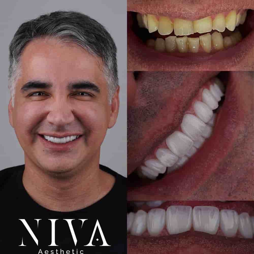 Verified Patient Reviews of Best Dental Clinic in Istanbul - Niva Aesthetic in Istanbul, Turkey Slider image 8