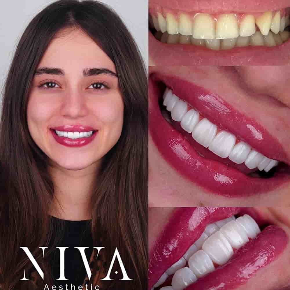 Verified Patient Reviews of Best Dental Clinic in Istanbul - Niva Aesthetic in Istanbul, Turkey Slider image 5