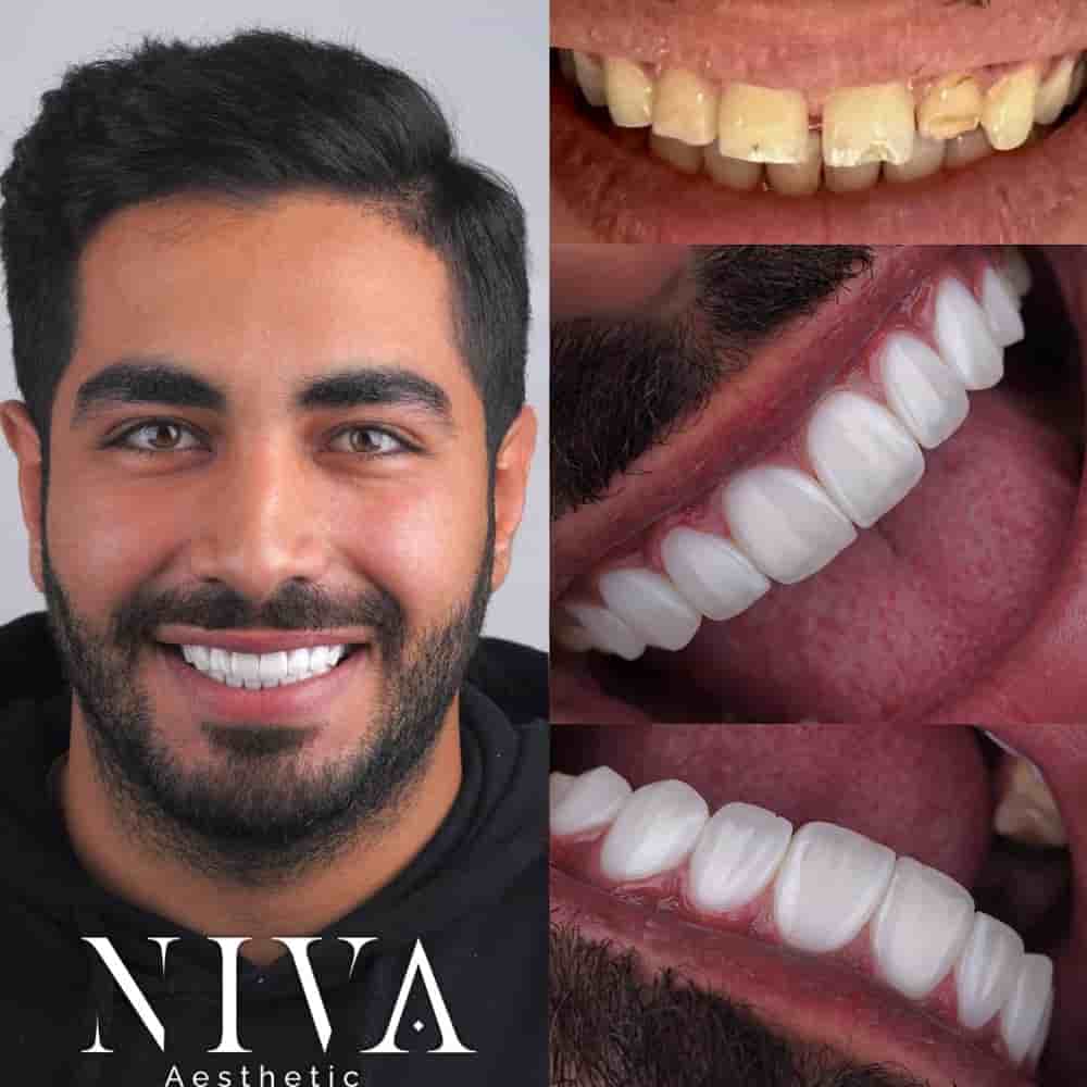 Verified Patient Reviews of Best Dental Clinic in Istanbul - Niva Aesthetic in Istanbul, Turkey Slider image 6