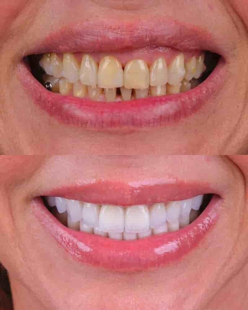 Verified Patient Reviews of Best Dental Clinic in Istanbul - Niva Aesthetic in Istanbul, Turkey Slider image 9