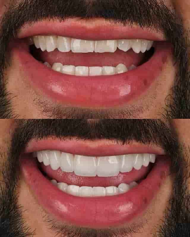 Verified Patient Reviews of Best Dental Clinic in Istanbul - Niva Aesthetic in Istanbul, Turkey Slider image 10