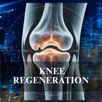 Knee Regenerative Medicine Package in Osaka, Japan by Cell Grand Clinic