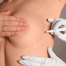 Breast Lift Surgery Package in Merida, Mexico by Dr. Ernesto