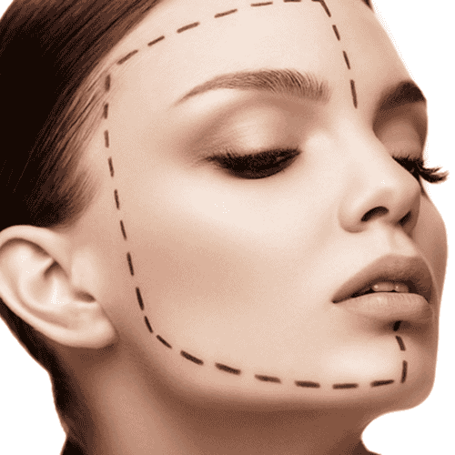 Facelift Surgery Package in Tijuana, Mexico by Top Surgeons