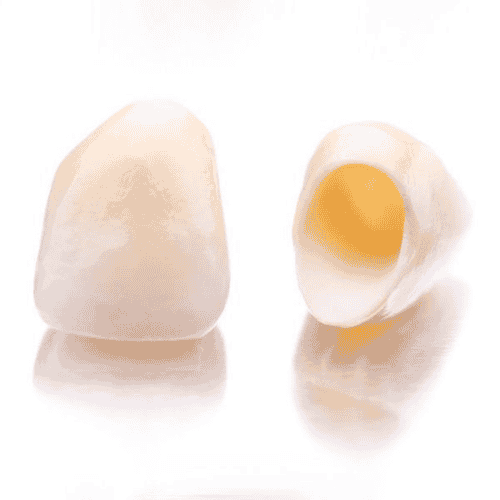 Dental Crowns in Los Algodones, Mexico